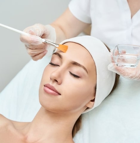 Image13562022 03 03 17 53 18chemicalpeel featured