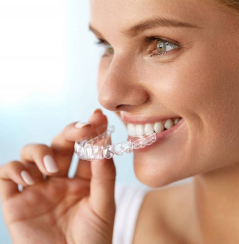 Image13792022 03 03 10 37 11bracesaligners