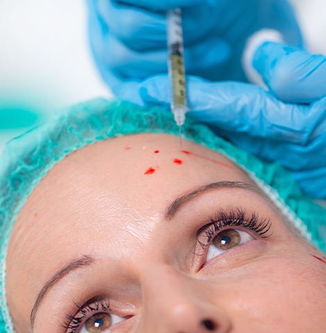 Image14842022 03 09 16 52 45prp with vampire face lift featured