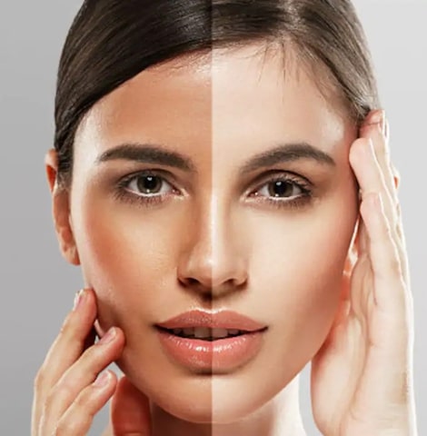 Image15522022 03 03 17 59 49skinwhitning featued
