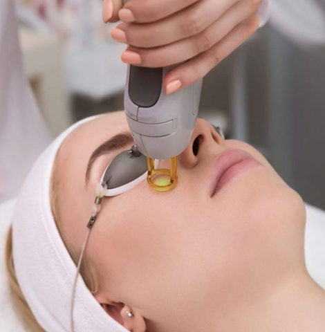 Image19922022 03 09 16 39 01co2 fractional laser featured