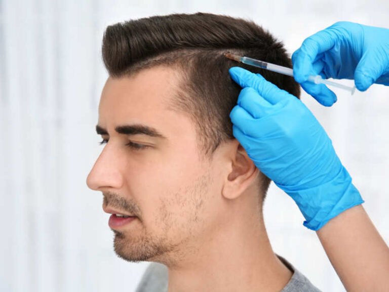 Prp treatment
